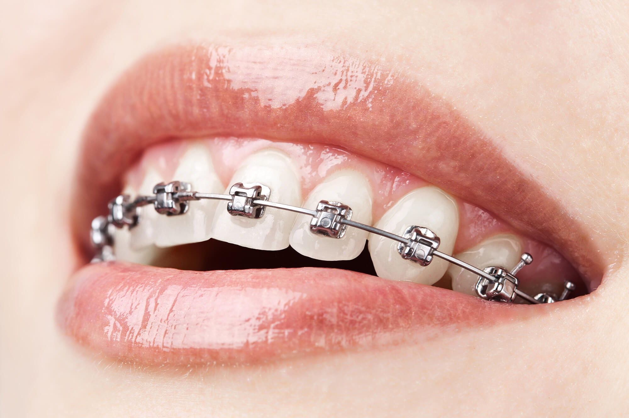 ortodoncja