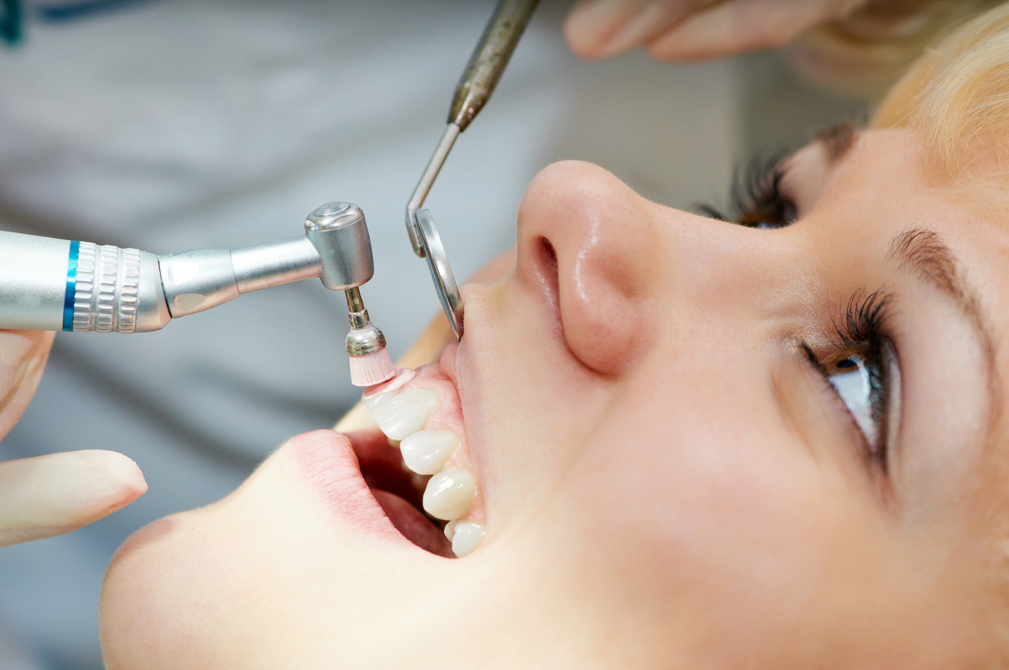 parodontologia i higiena jamy ustnej
